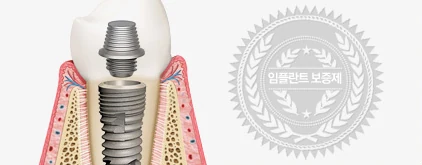 정품 임플란트와 사후 관리
